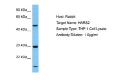 HARS2 Rabbit anti-Human, Polyclonal, Novus Biologicals 0.1ml; Unconjugated:Antibodies,